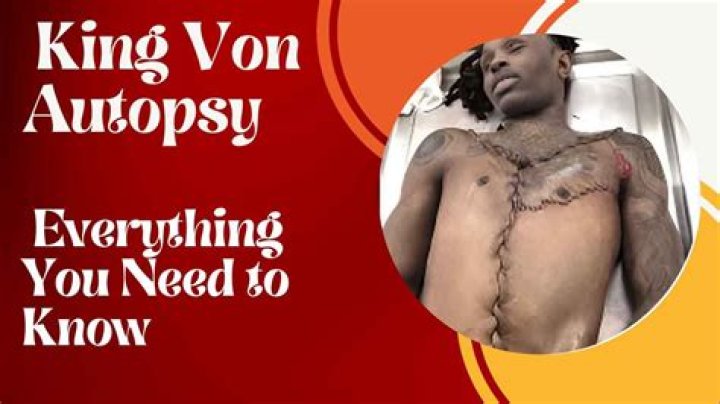 Unraveling The Mystery Of King Von Autopsy